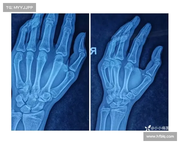 坎贝尔位置分析与比赛表现解读及未来发展推荐